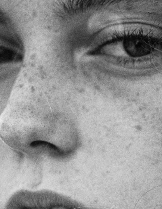 Close up black and white image of a freckled model.